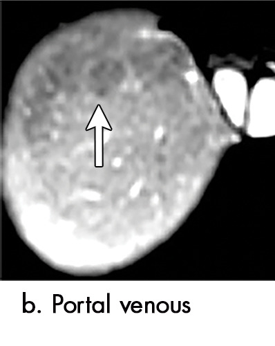 Figure 2b: