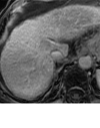 Figure 10d:
