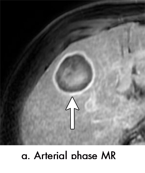 Figure 4a: