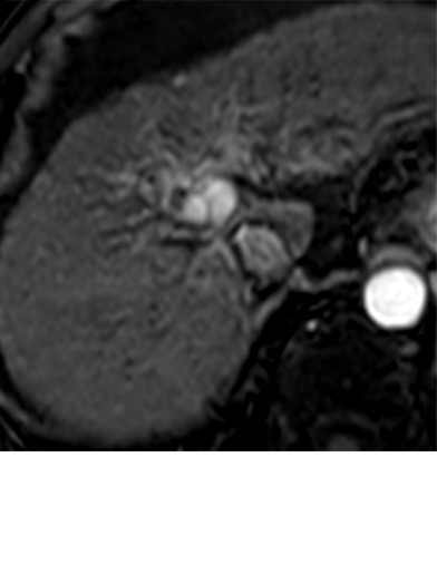 Figure 10e: