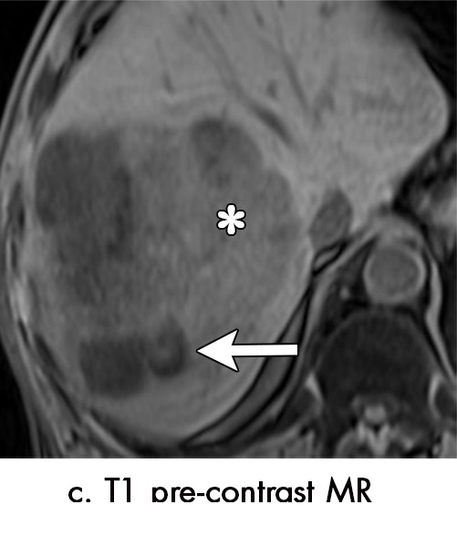 Figure 4c: