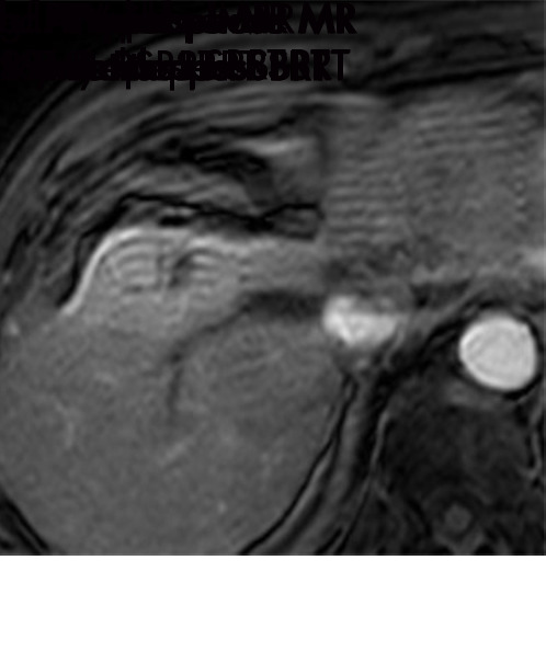 Figure 11c: