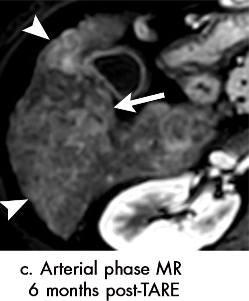 Figure 7c: