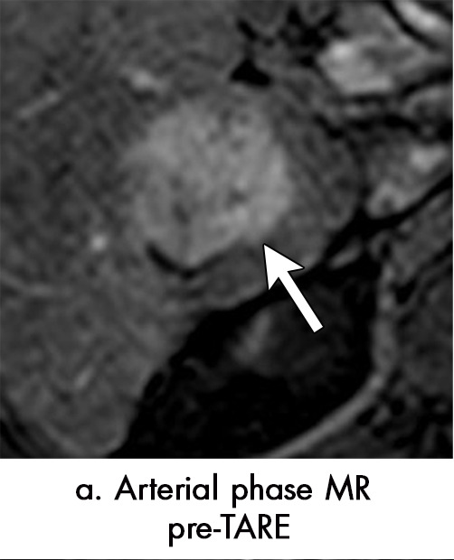 Figure 6a: