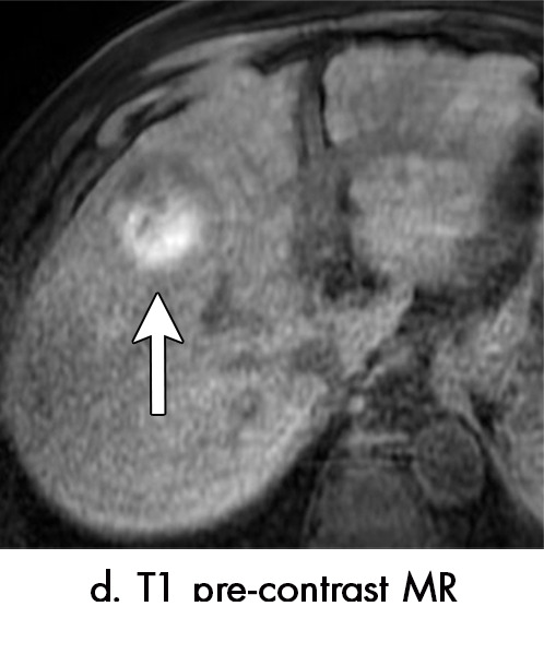 Figure 4d: