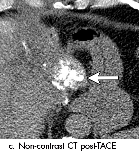 Figure 5c: