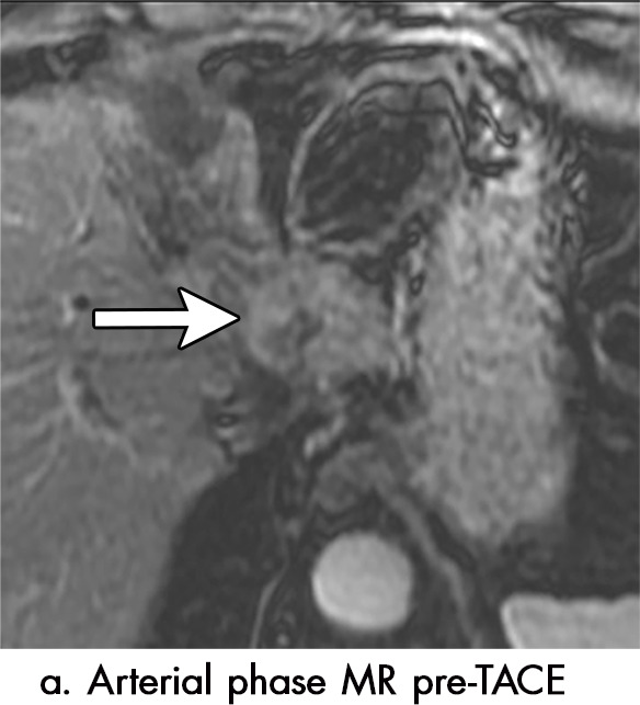 Figure 5a: