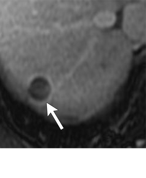 Figure 7f: