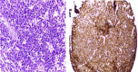 [Table/Fig-6a,b]: