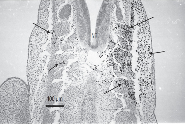 Fig. 16.