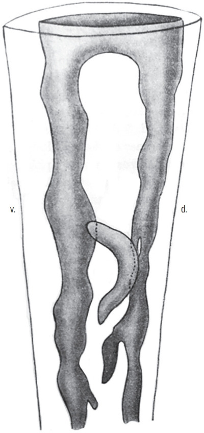 Fig. 11.