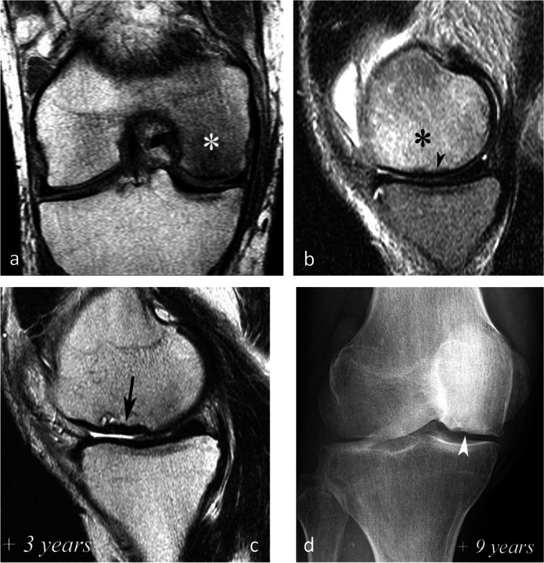 Fig. 20