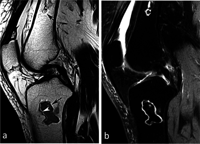 Fig. 33