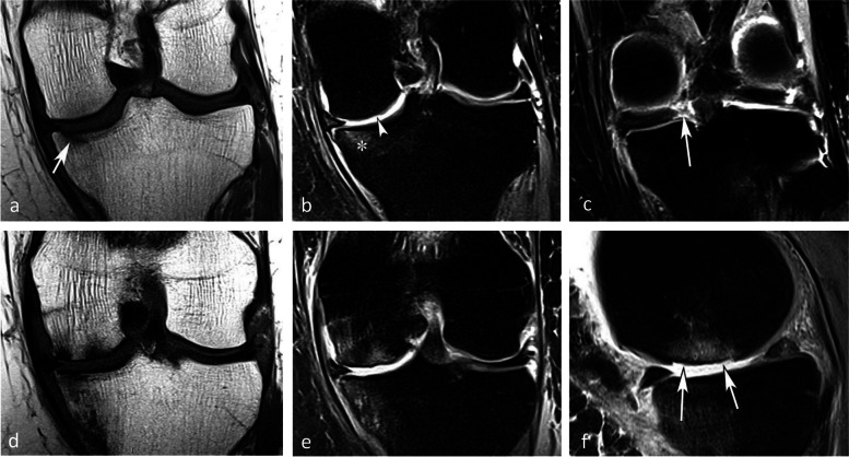 Fig. 29