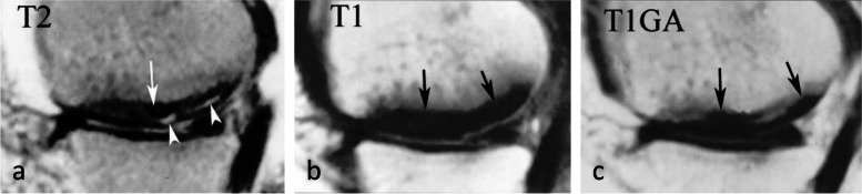 Fig. 16