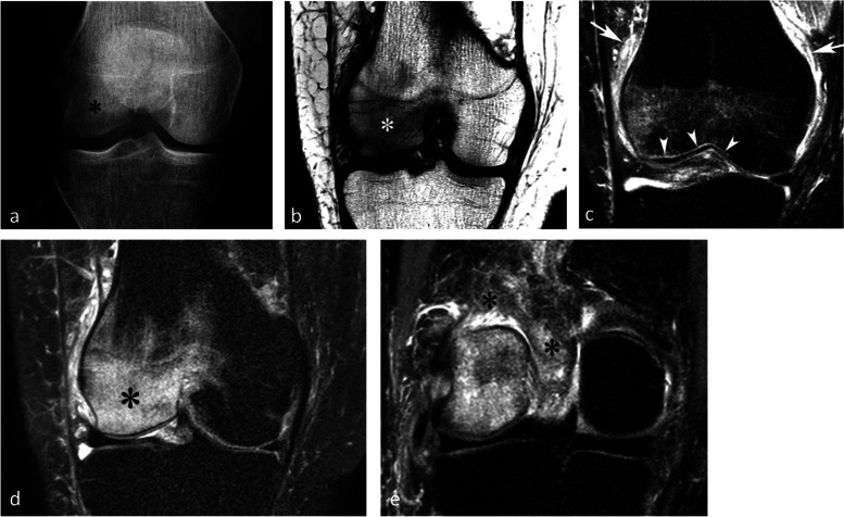 Fig. 24