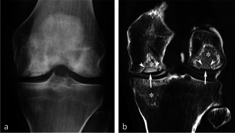 Fig. 31