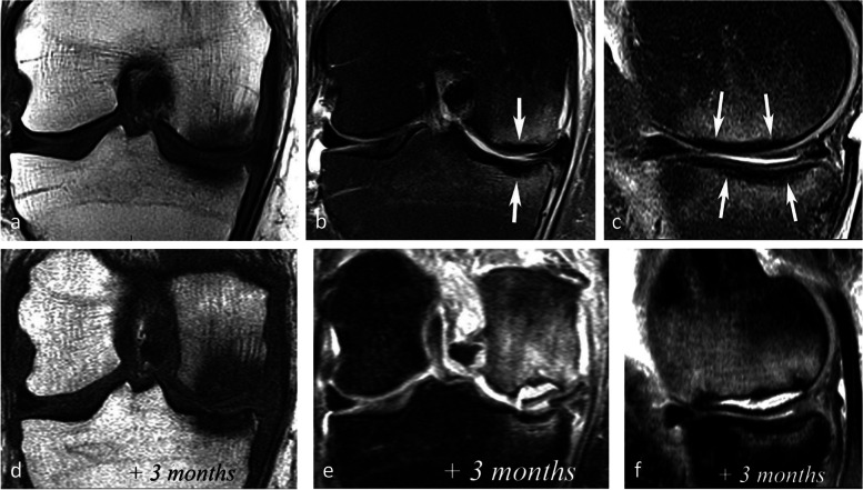 Fig. 17