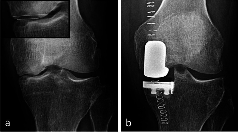 Fig. 22