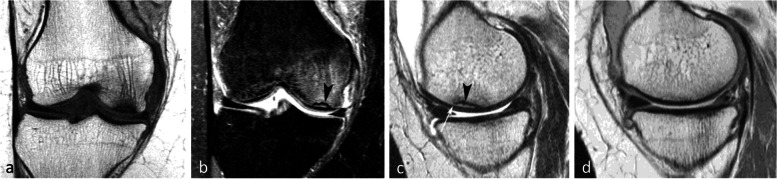 Fig. 12