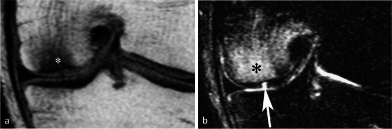 Fig. 27