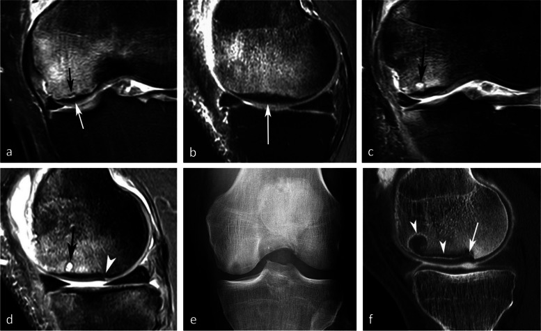 Fig. 15