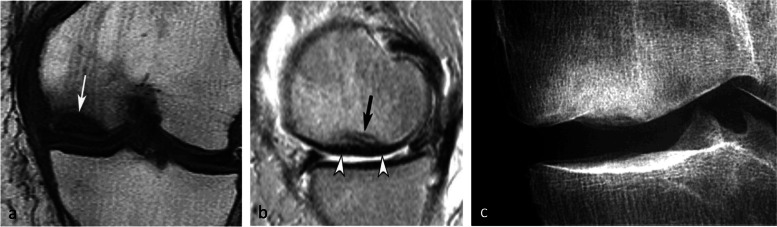 Fig. 18