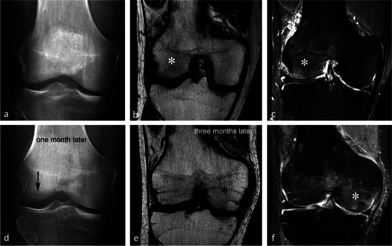 Fig. 26