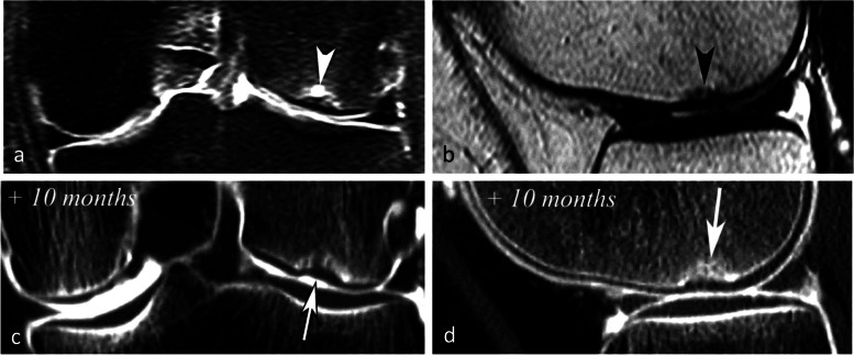 Fig. 23