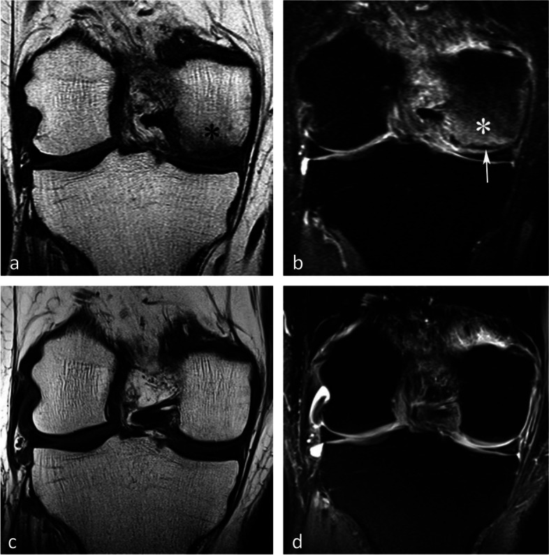 Fig. 19