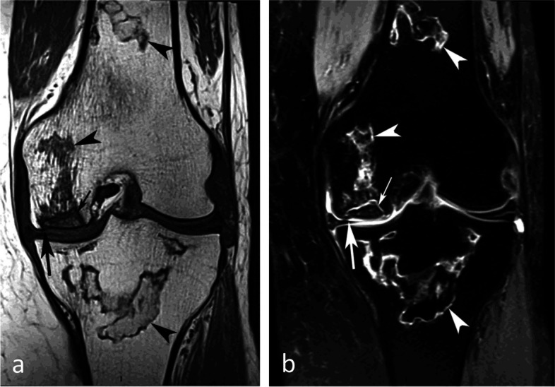 Fig. 32