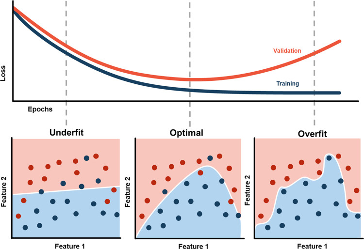 Graph demonstrates underfitting (left) and overfitting (right) of a model, which can result in poor predictive performance on future unseen data.