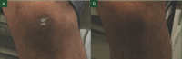 FIGURES 3A–B.