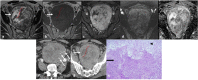 Fig. 10
