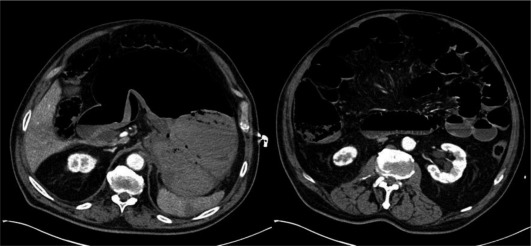 Fig. 2