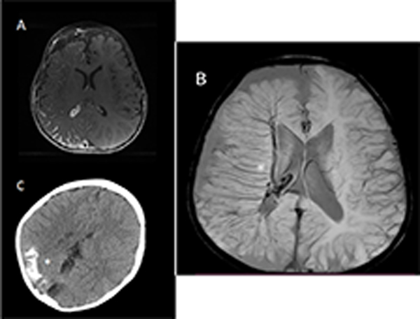 Figure 2: