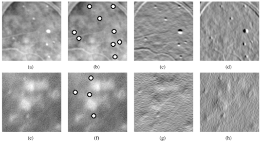 Fig. 11