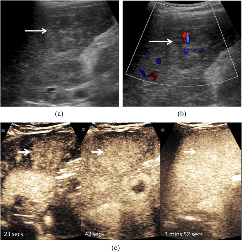 Figure 2.