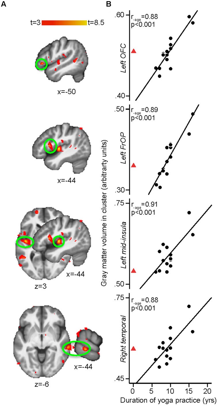 FIGURE 3