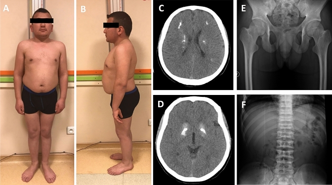 Fig. 2