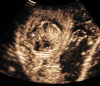 Fig. 2