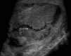 Fig. 6