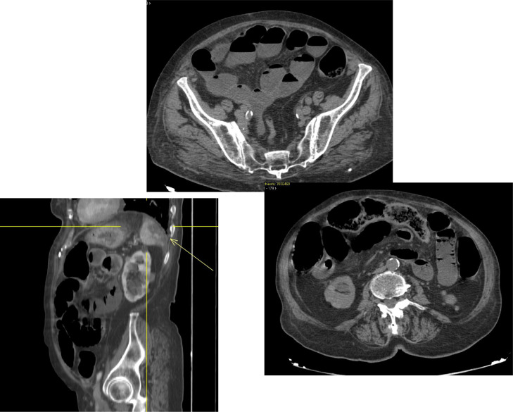 Fig 3