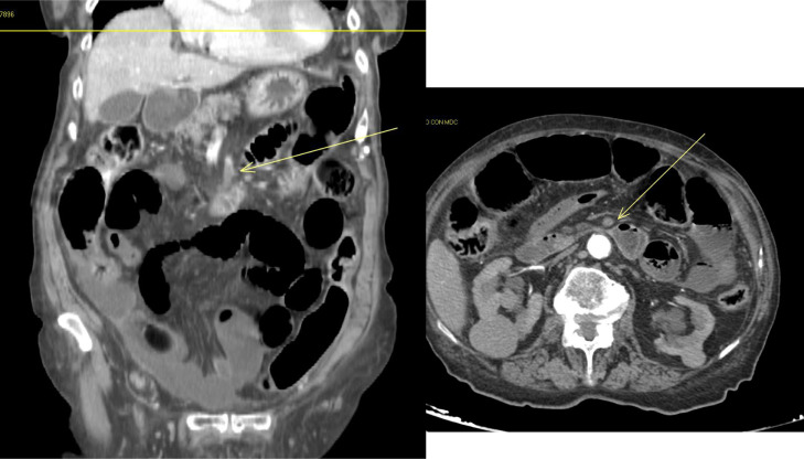 Fig 2