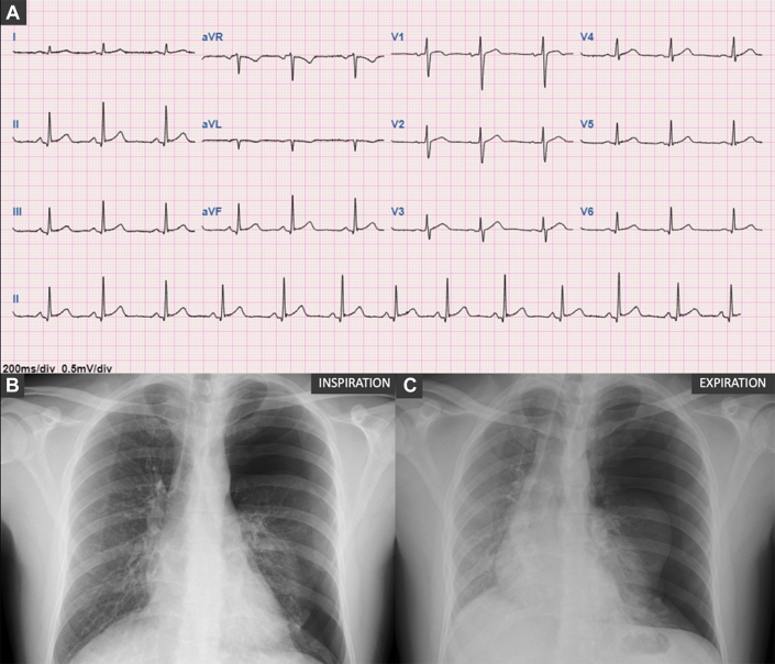 Figure 1