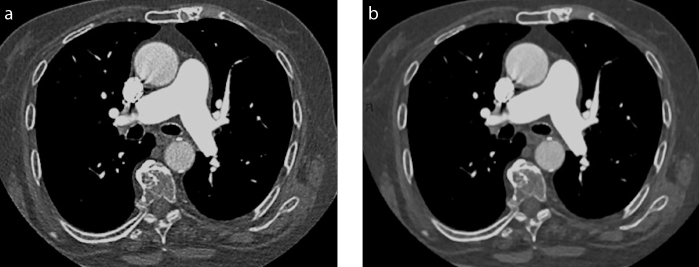 Figure 1. a, b