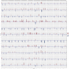 Figure 6—figure supplement 1.
