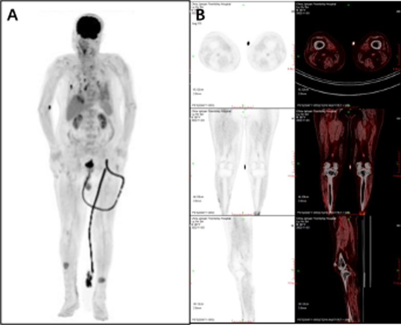 Fig. 2