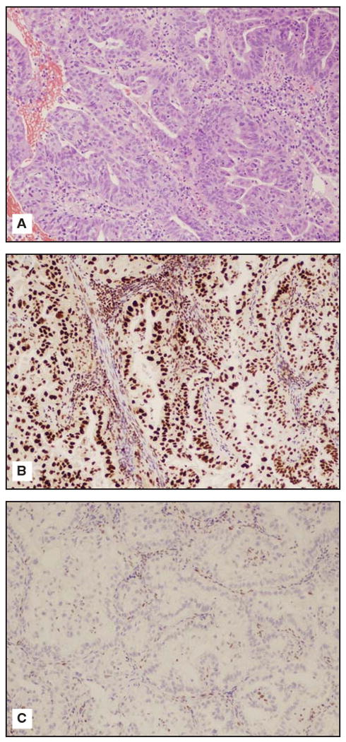 Fig 1A-C