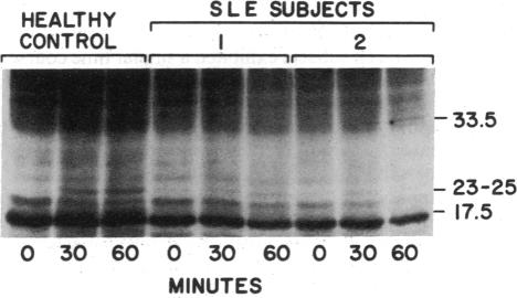 graphic file with name pnas01030-0359-a.jpg